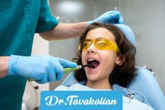 مزیت های فلوراید تراپی برای کودکان زیر ۶ سال