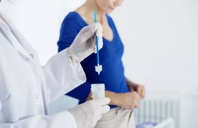 آزمایش HPV چیست و چه کسانی باید تست hpv بدهند؟