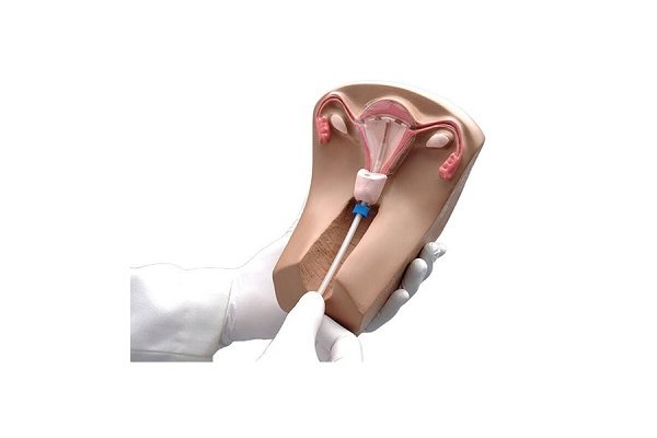دلیل حس نکردن نخ آیودی دلیل حس نکردن نخ آیودی
