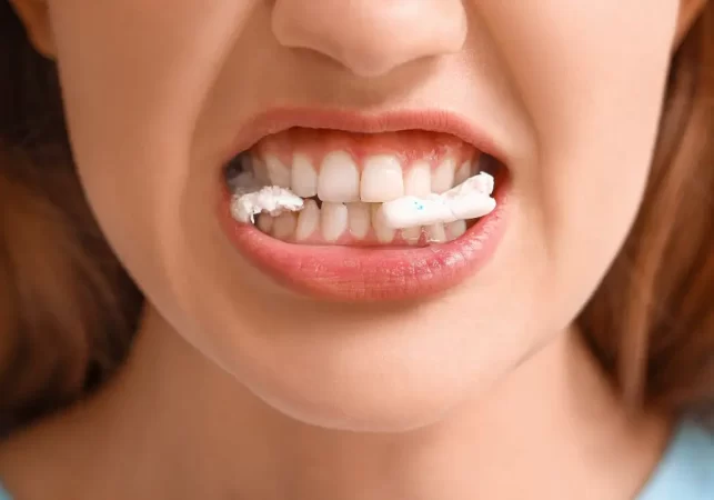 علت درد دندان نیش سالم چیست؟