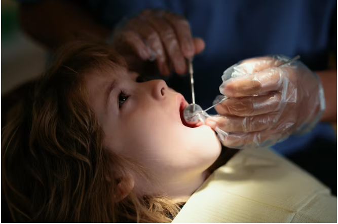 فلوراید تراپی سادهترین راه برای داشتن دندانهایی سالم و قوی فلورایدتراپی کودکان