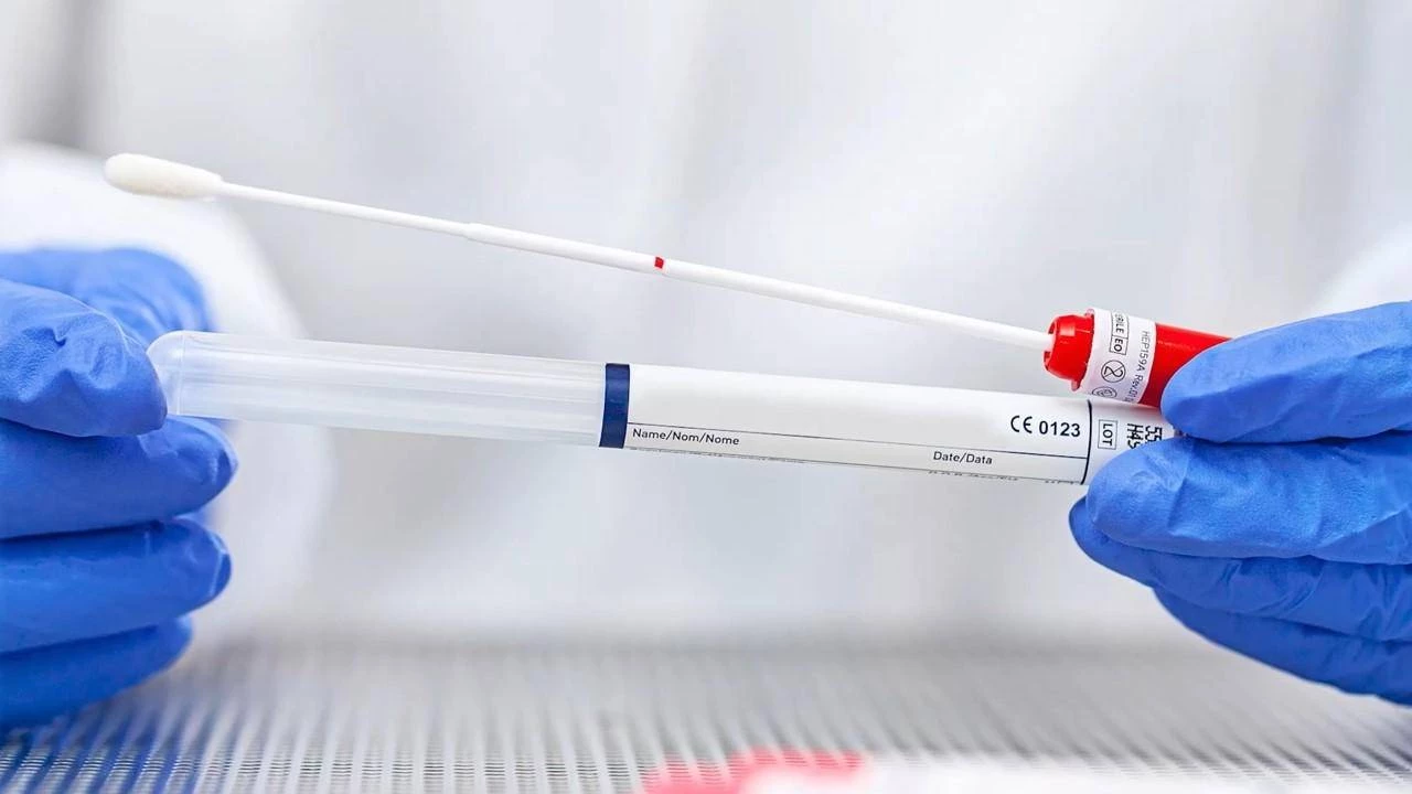چه کسانی باید آزمایش HPV انجام دهند؟