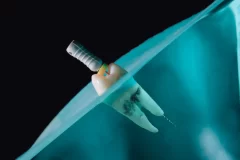 ۵ علت اصلی زرد شدن دندان ها کدامند؟