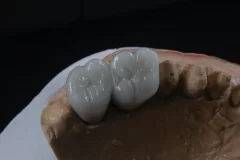 تکنیک لیرینگ کامپوزیت چیست