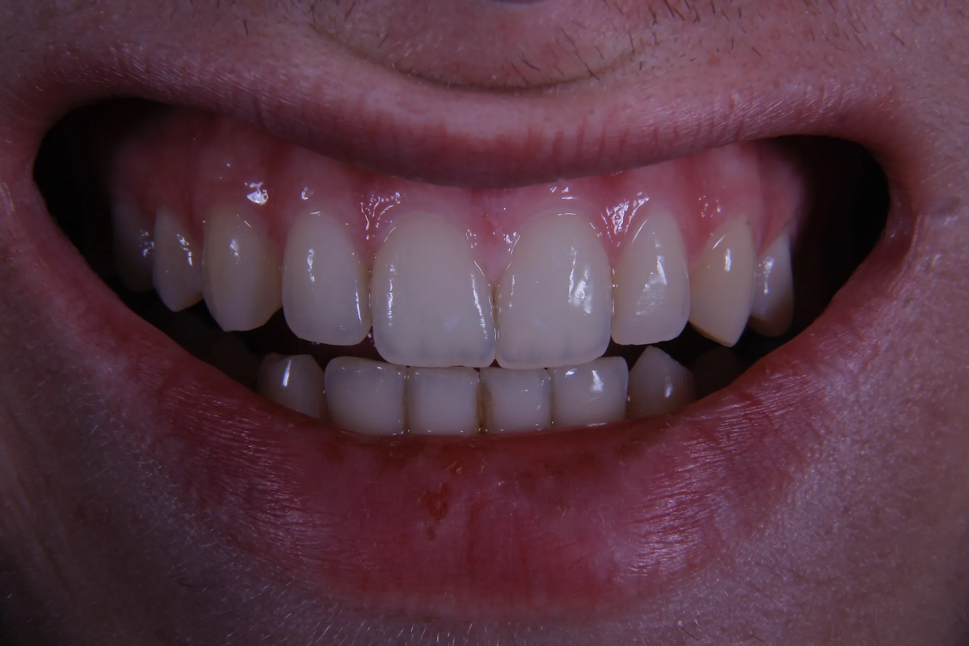 بهترین دکتر دندانپزشک در تهران کیست ؟ انتخاب دندانپزشک خوب