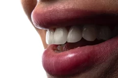 متخصص پروتز دندان خوب