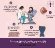 صفرتا صد بیماری واژینیسموس را اینجا بخوانید!