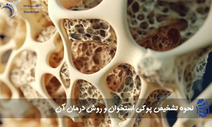 نحوه تشخیص پوکی استخوان و روش درمان آن نحوه تشخیص پوکی استخوان و روش درمان آن