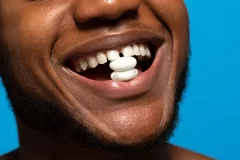 ایمپلنت دندان با بیهوشی