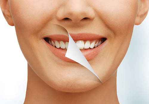 چرا وقتی میخندم دندونام مشخص نمیشه ؟