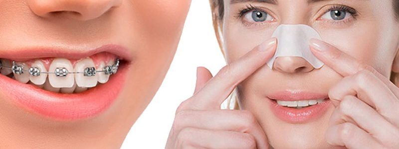  رویکردهای مشترک بین ارتودنسی و بینی