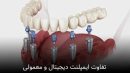 تفاوت ایمپلنت دیجیتال و ایمپلنت معمولی در چیست؟