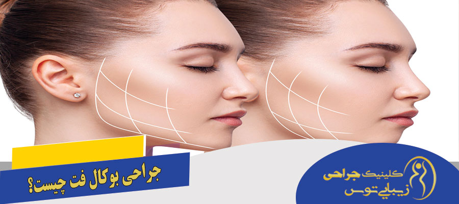 بهترین جراح بوکال فت در مشهد از نظر مردم بهترین جراح بوکال فت مشهد