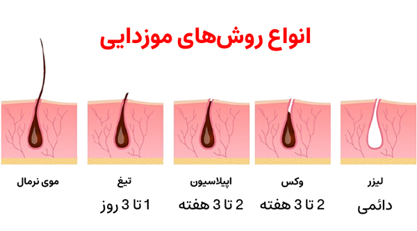 روش های موزدایی