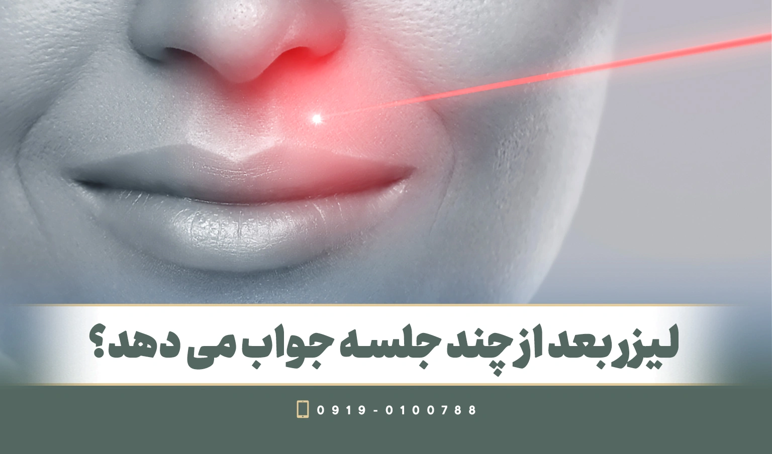 آیا لیزر برای همیشه مو را از بین می برد؟ لیزر موهای زائد