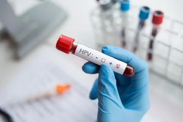 آزمایش خون HPV